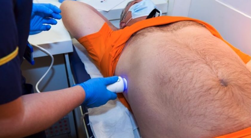 Call for increased efforts to address rising number of deaths in Wales caused by liver disease
