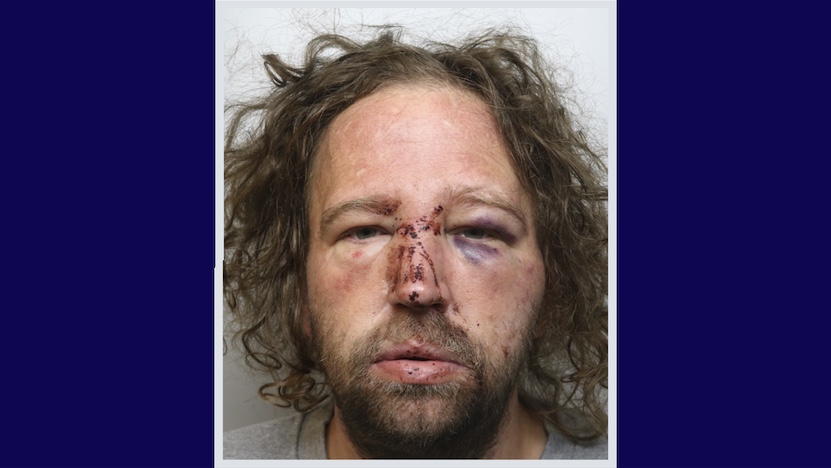 Man banned from Chester city centre for five years after being issued a criminal behaviour order
